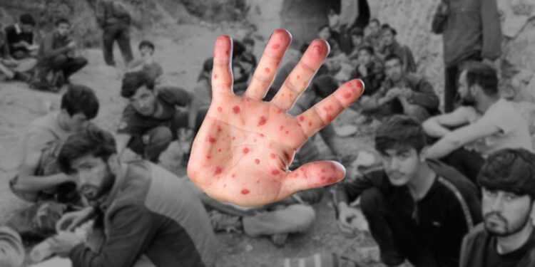 AKP’nin sığınmacı istilası ve aşı karşıtlığı, ölümcül salgınlara sebep oluyor